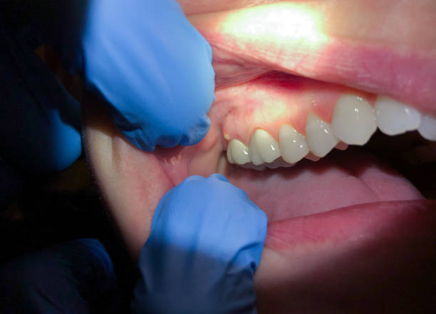 Best Walk-In Emergency Dental Services in Navasota, TX
