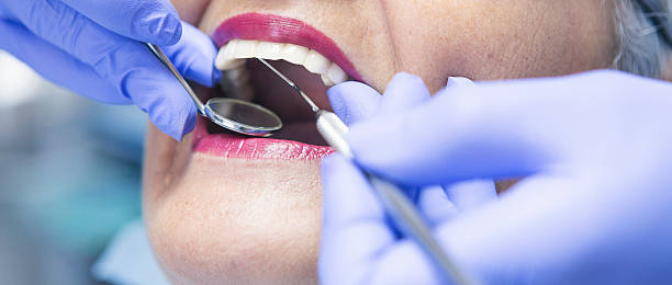 Best Knocked-Out Tooth (Avulsed Tooth) Treatment in Navasota, TX